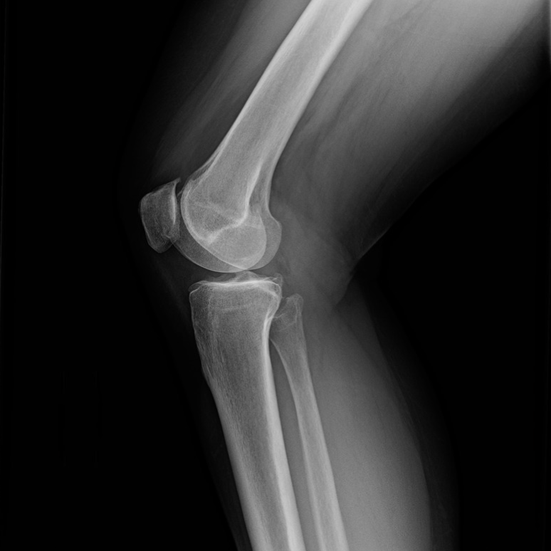 xray services